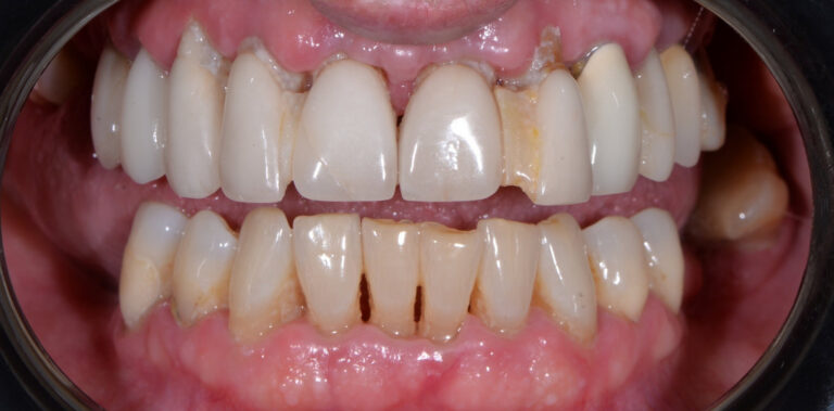 Метаморфоза 42 - przed