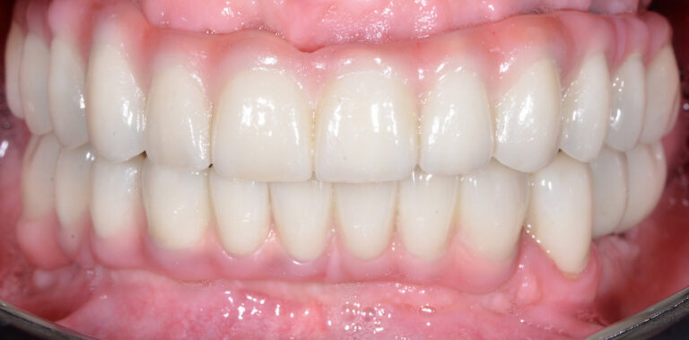 Метаморфоза 44 - po