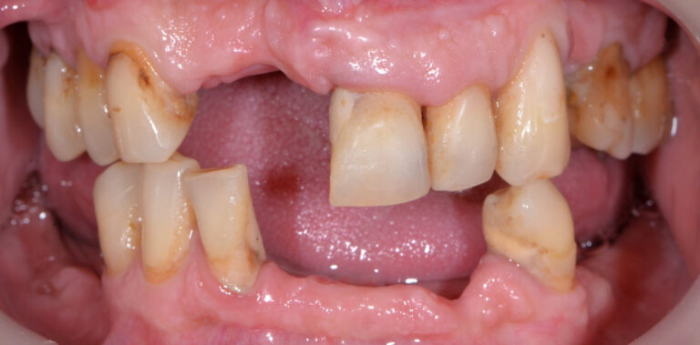 Метаморфоза 44 - przed