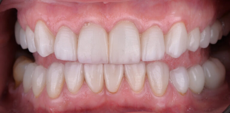 Метаморфоза 32 - po