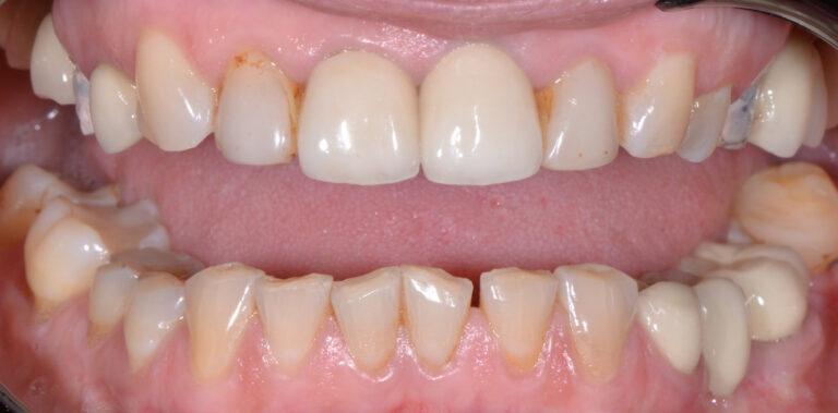 Метаморфоза 32 - przed