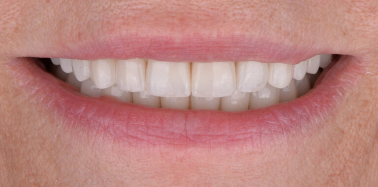 Метаморфоза 19 - po