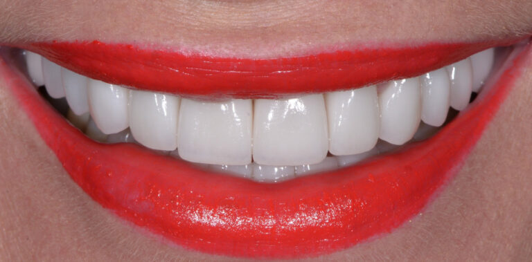 Метаморфоза 66 - po