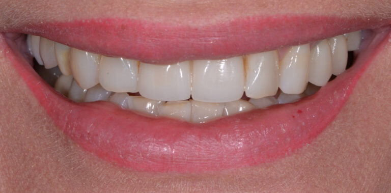 Метаморфоза 66 - przed