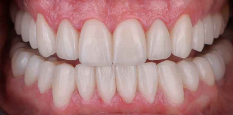 Метаморфоза 15 - po