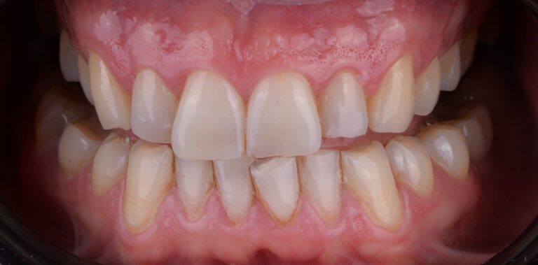 Метаморфоза 15 - przed