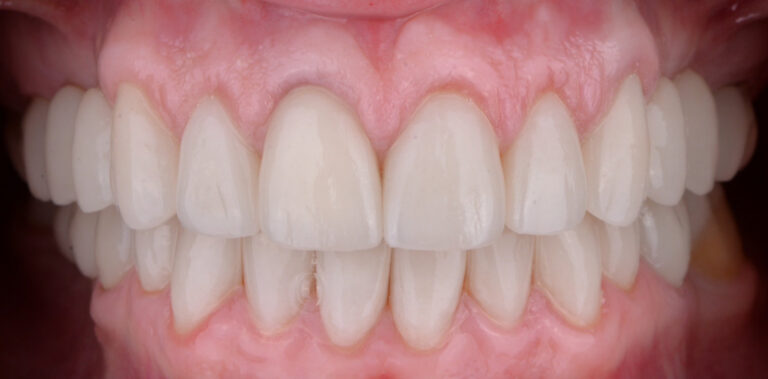 Метаморфоза 46 - po