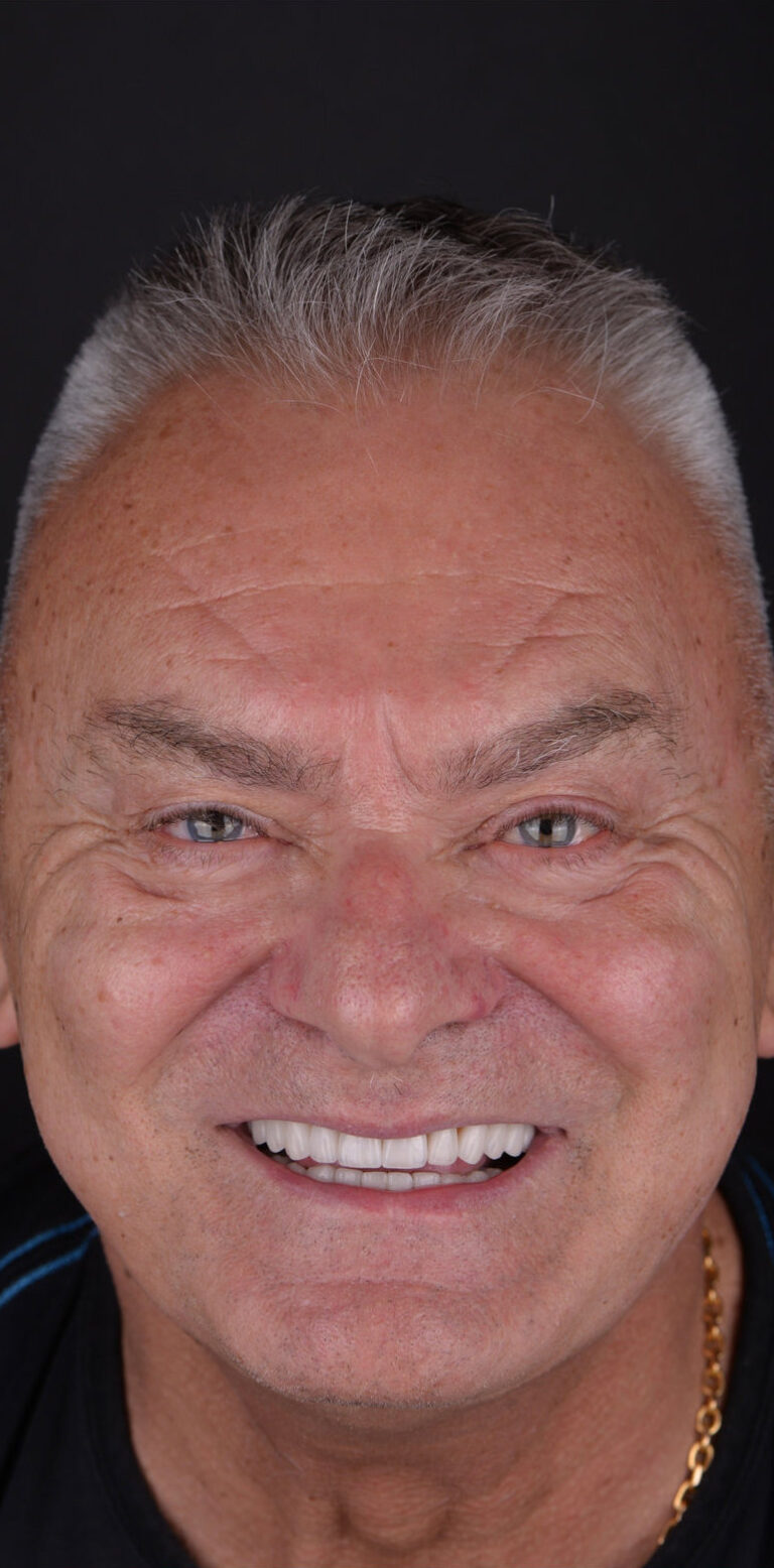 Метаморфоза 98 - po