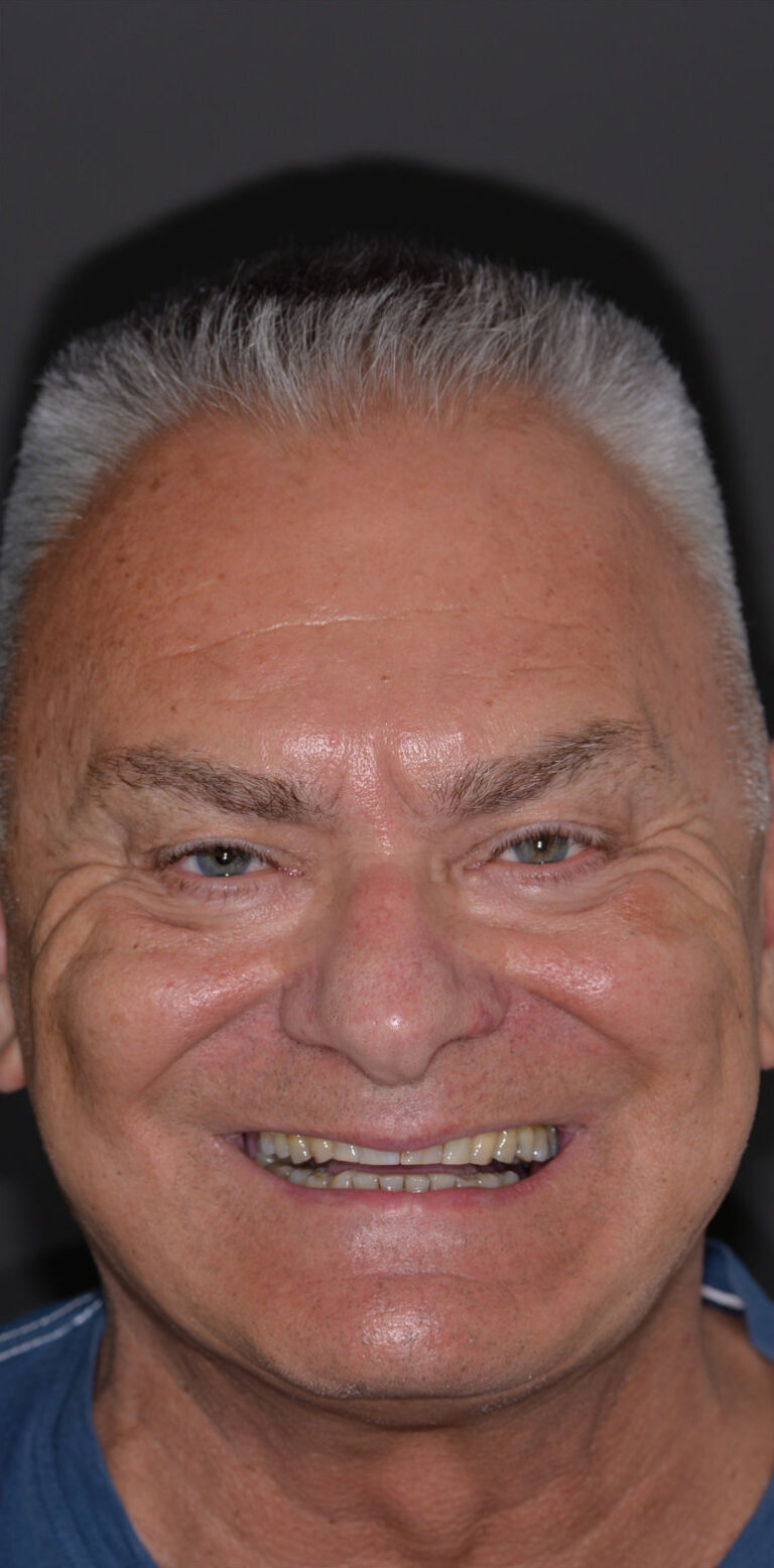 Метаморфоза 98 - przed