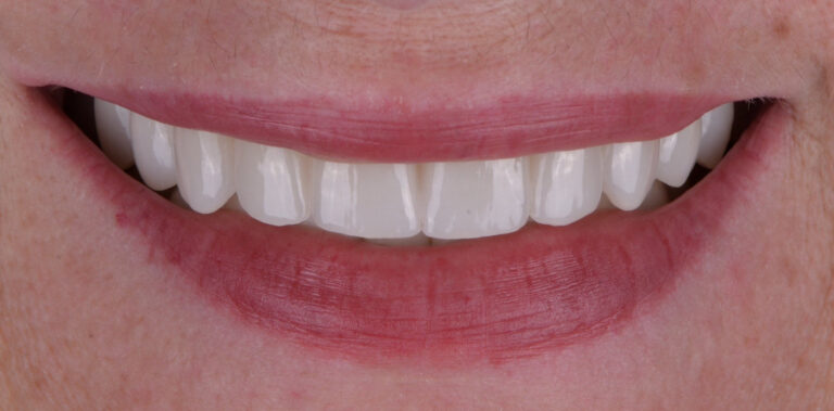 Метаморфоза 67 - po