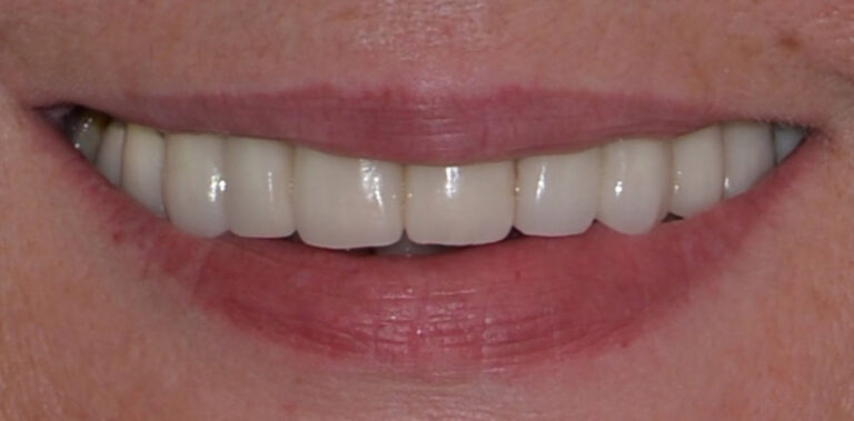 Метаморфоза 67 - przed