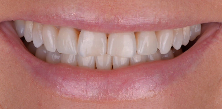 Метаморфоза 86 - przed