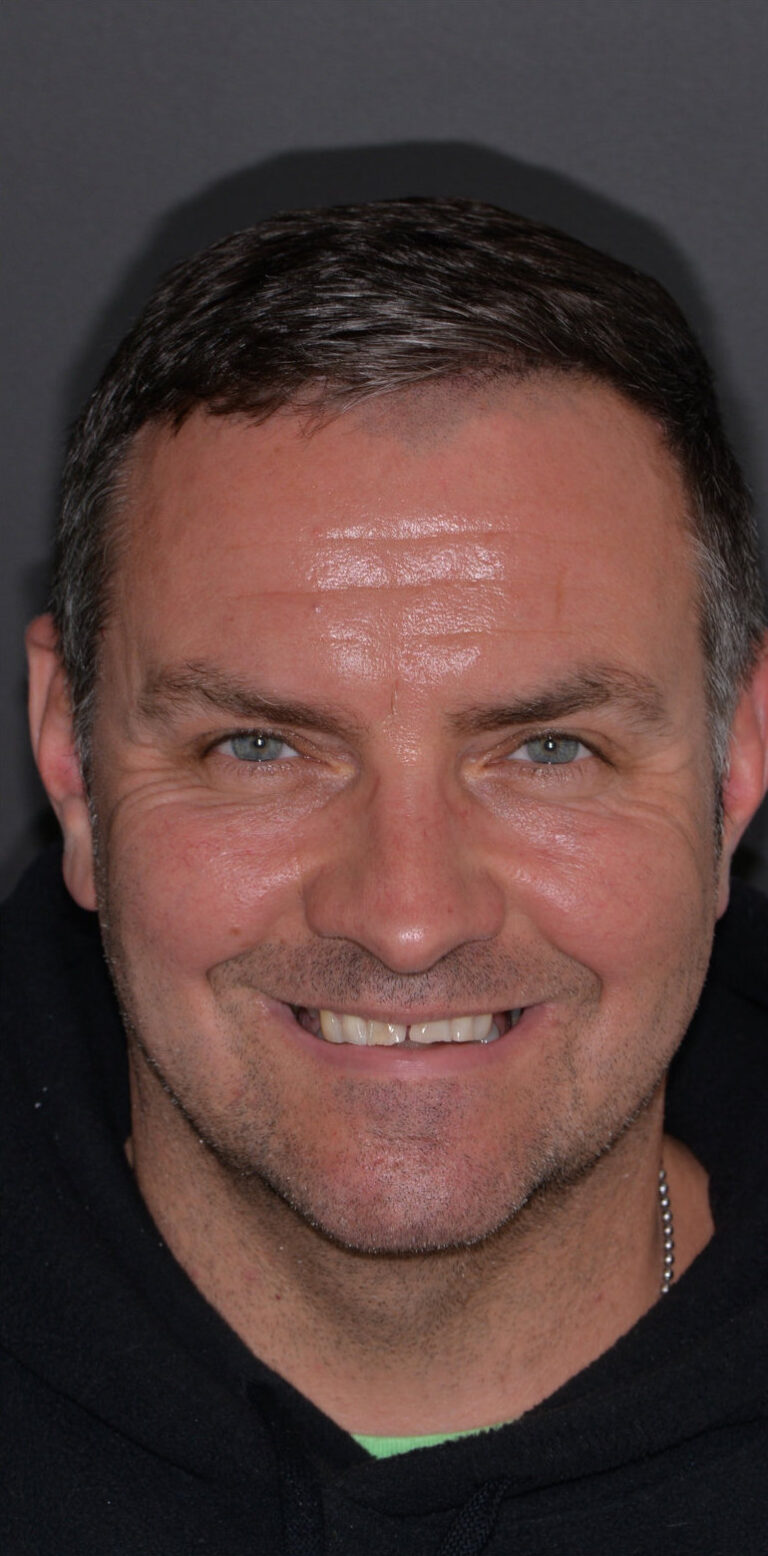 Метаморфоза 99 - przed