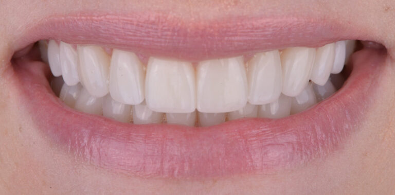 Метаморфоза 1 - po