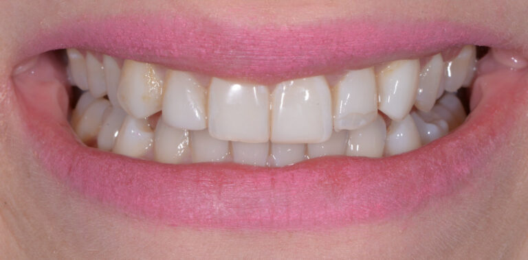 Метаморфоза 1 - przed