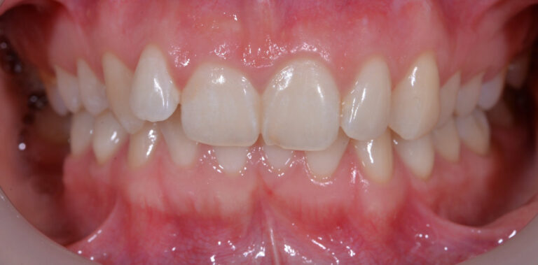 Метаморфоза 40 - przed