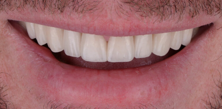 Метаморфоза 68 - po