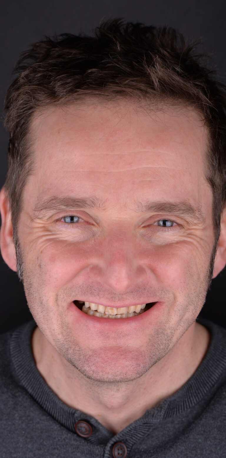 Метаморфоза 97 - przed