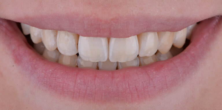 Метаморфоза 62 - po