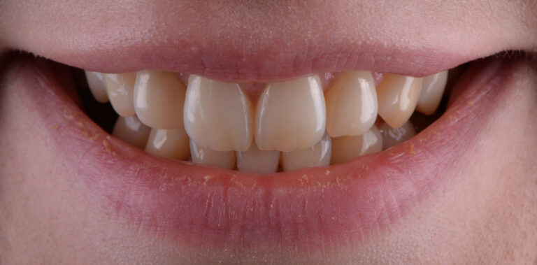 Метаморфоза 62 - przed