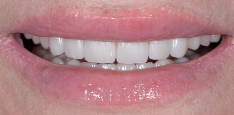 Метаморфоза 41 - po