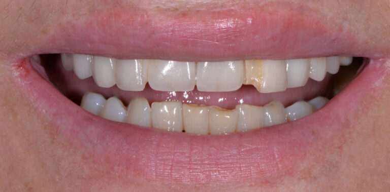 Метаморфоза 41 - przed