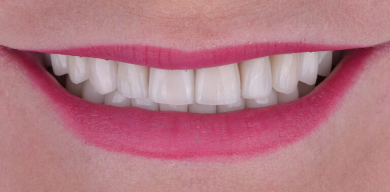 Метаморфоза 47 - po