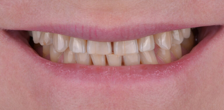 Метаморфоза 47 - przed