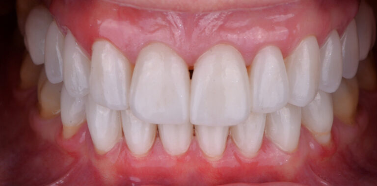 Метаморфоза 30 - po