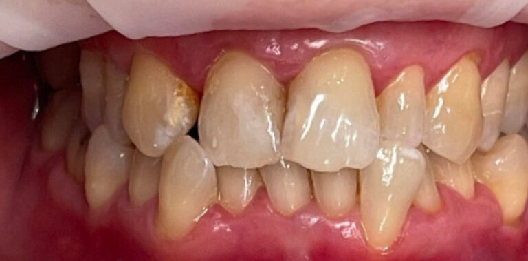 Метаморфоза 30 - przed