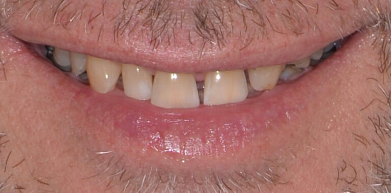 Метаморфоза 69 - przed