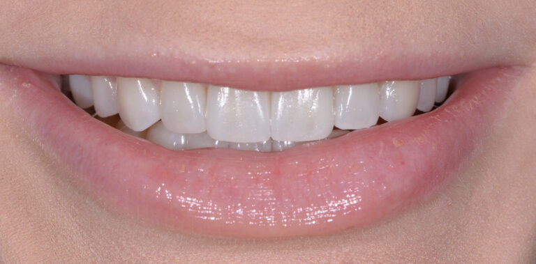 Метаморфоза 27 - po