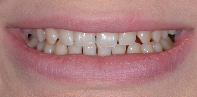 Метаморфоза 27 - przed