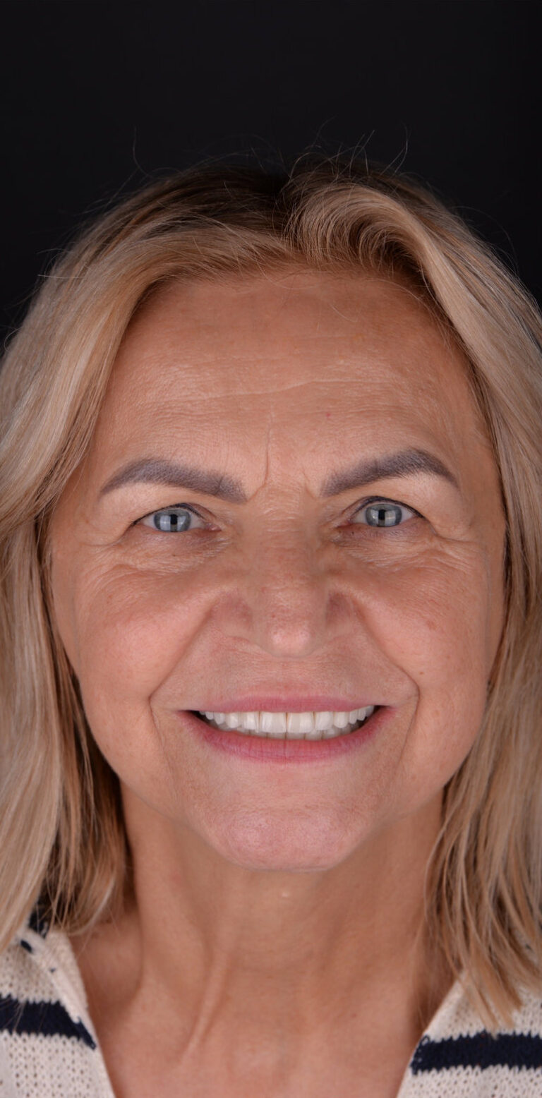 Метаморфоза 96 - po