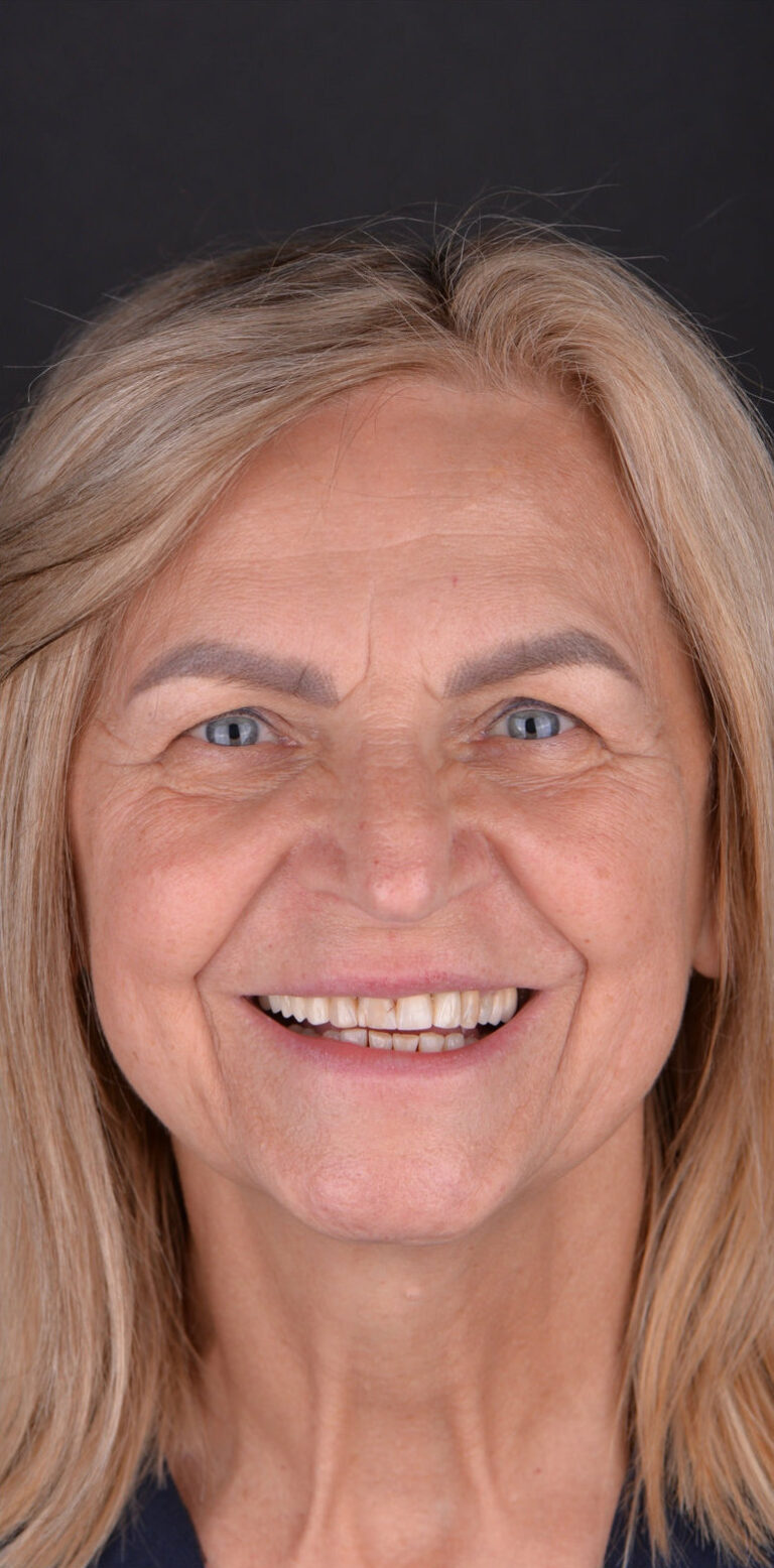 Метаморфоза 96 - przed