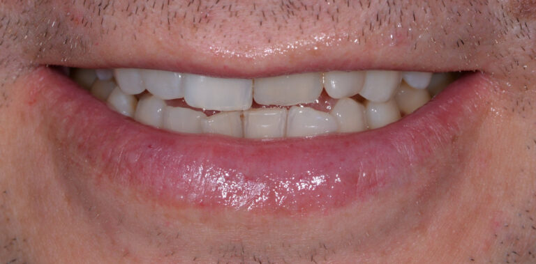 Метаморфоза 76 - przed