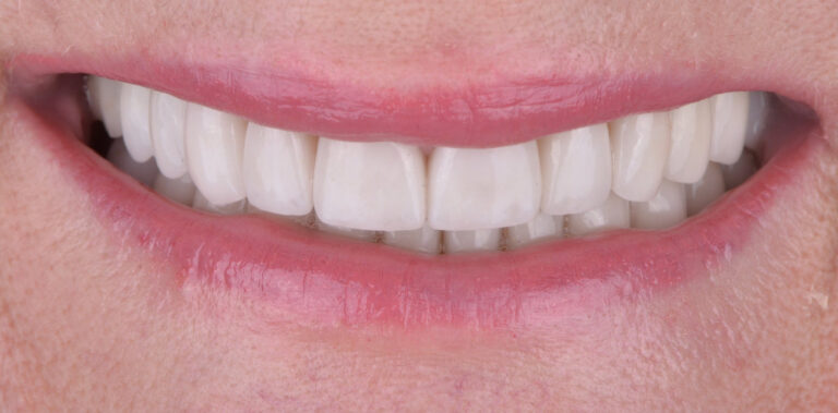 Метаморфоза 71 - po