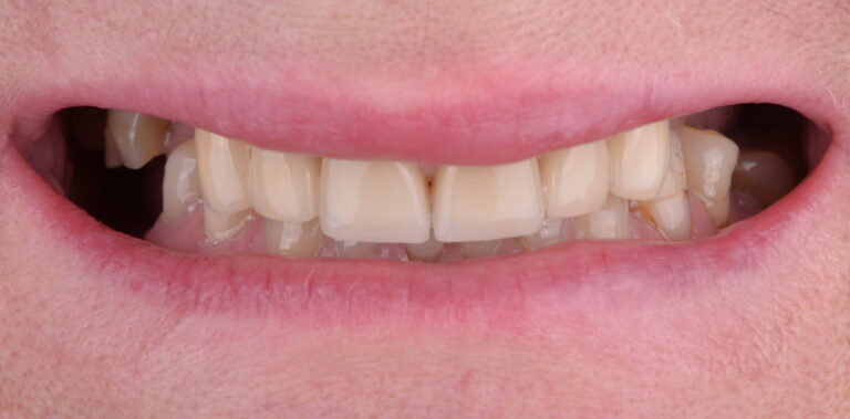 Метаморфоза 71 - przed