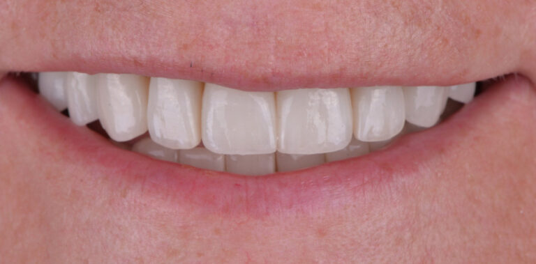 Метаморфоза 81 - po