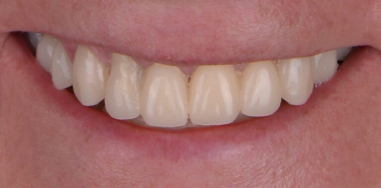 Метаморфоза 81 - przed