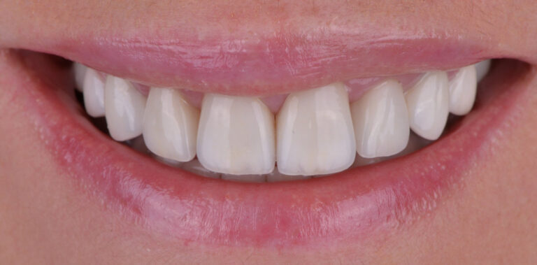 Метаморфоза 72 - po