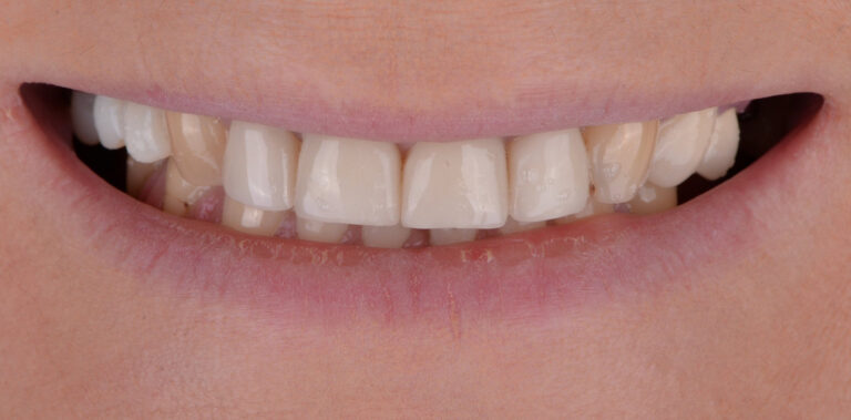 Метаморфоза 20 - przed