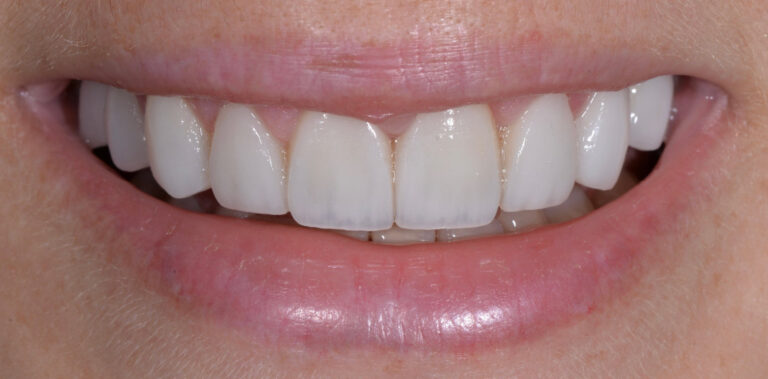 Метаморфоза 82 - po