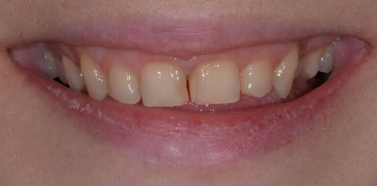 Метаморфоза 82 - przed