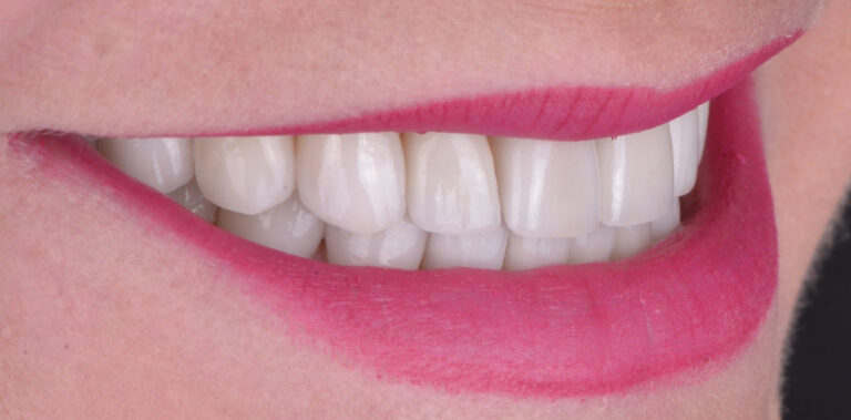 Метаморфоза 48 - po