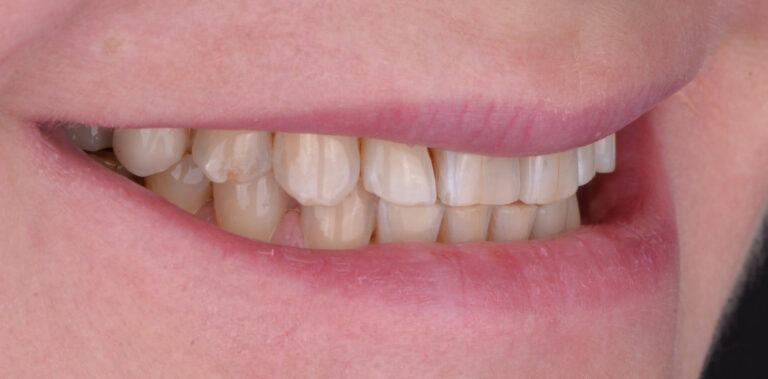 Метаморфоза 48 - przed