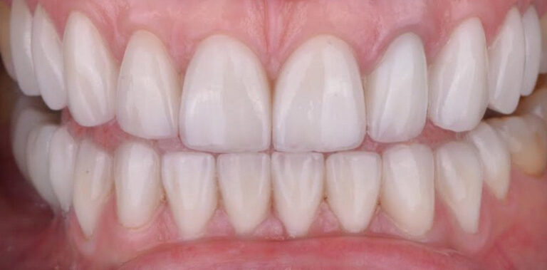 Метаморфоза 26 - po