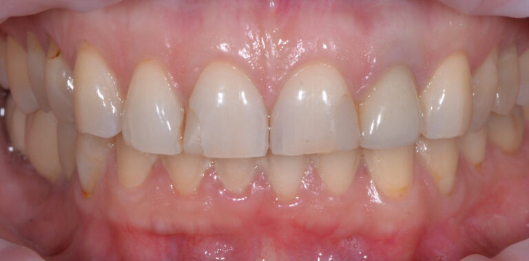 Метаморфоза 26 - przed