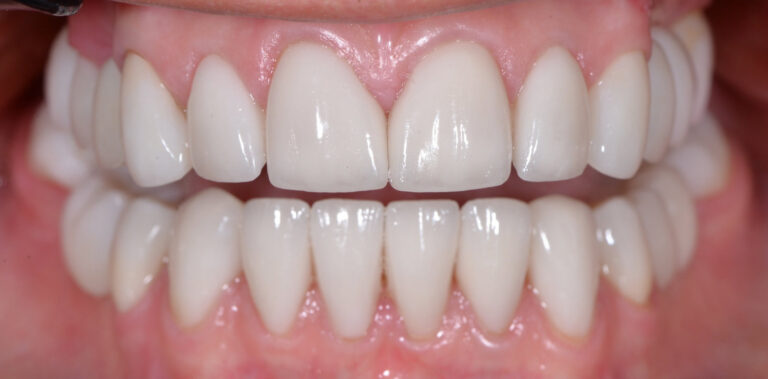 Метаморфоза 85 - po