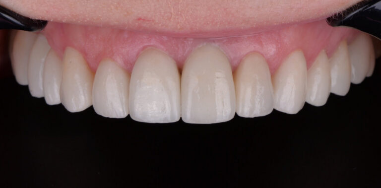 Метаморфоза 61 - po